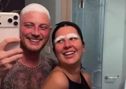 Майя Донцова сделала пересадку бровей